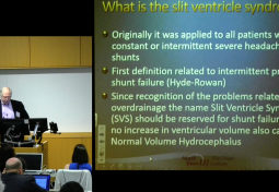 DIAGNOSIS & MANAGEMENT OF SLIT VENTRICLE SYNDROME