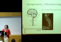 CURRENT MANAGEMENT & TREATMENT OF TETHERED CORD & SYRINGOMYELIA