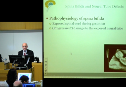 FETAL MANAGEMENT OF SPINA BIFIDA & CHIARI MALFORMATION