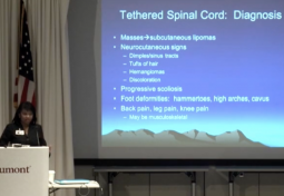 Tethered Spinal Cord Syndrome