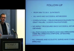 THE COMPLEX CHIARI MALFORMATION