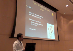 La Malformación de Chiari y Siringomielia