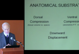 Symptoms & Signs of Cervical Medullary Syndrome in Chiari Patients