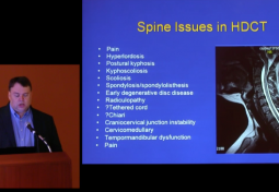 The Hypermobile Spine
