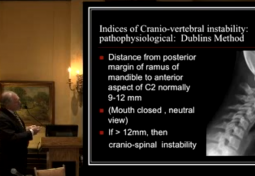 Indices of Cranio-vertebral Instability