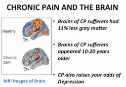 Pain Management