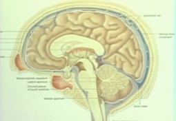 Chiari Diagnosis and Management: A Multidisciplinary Approach