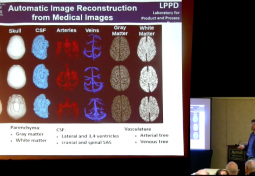 Intracranial Pressure & Water Exchange: What Clinicians & Scientists Think They Know