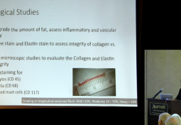 Clinically Relevant Filum Pathology in Tethered Cord Syndrome