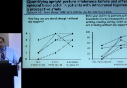 Orthostatic Intolerance & Epidural Interventions