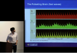 Association Between Pulsatile Components of Cerebral Blood Flow & ICP in Patients with Suspected Hydrocephalus