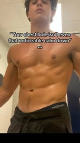 My friends really be making fortnite references about my chest #pectus #pectusexcavatum