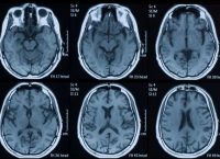 Basic Mri Part 2 Dc Hours
