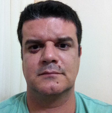 Robson Abreu