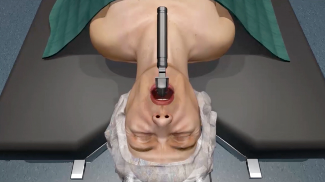 Medical Malpractice Causes Fatal Intubation