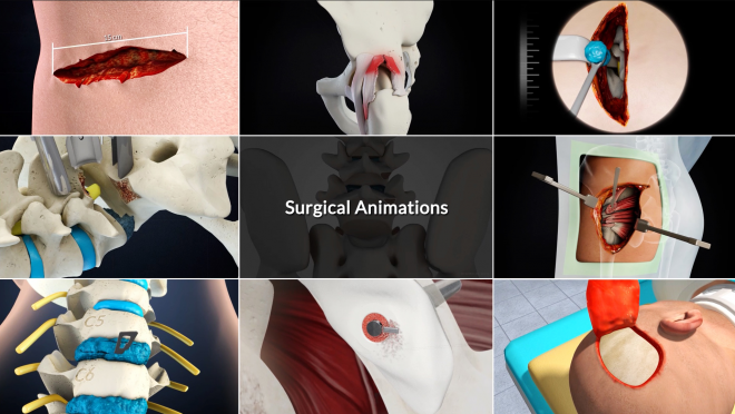 Multi-Million-Dollar Settlements & Verdicts for Damages Cases