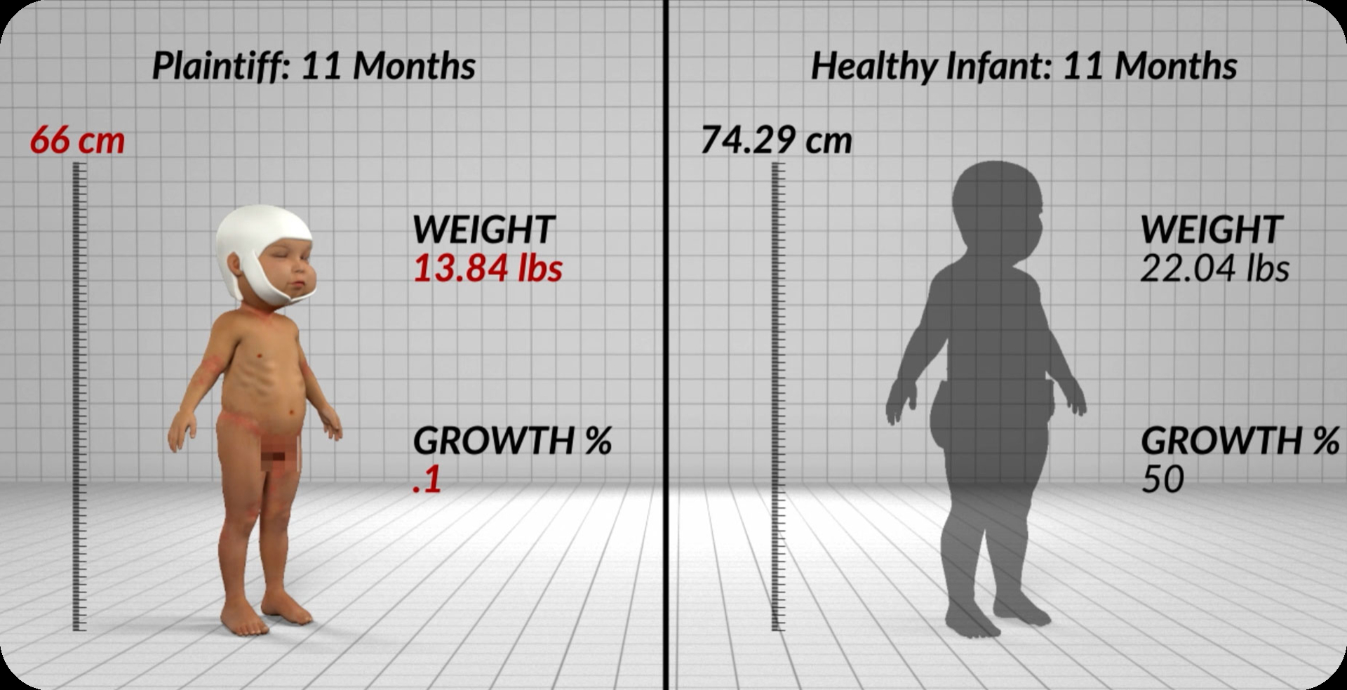 Infant Malnourished by Cult Parents Results in $32M Settlement from CPS and Apology