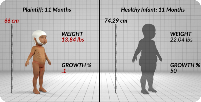 Infant Malnourished by Cult Parents Results in $32M Settlement from CPS and Apology