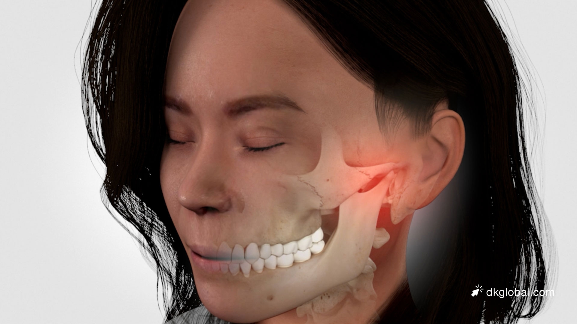 Car Passenger Suffers Skeletal Injuries and TBI From Reckless Driving