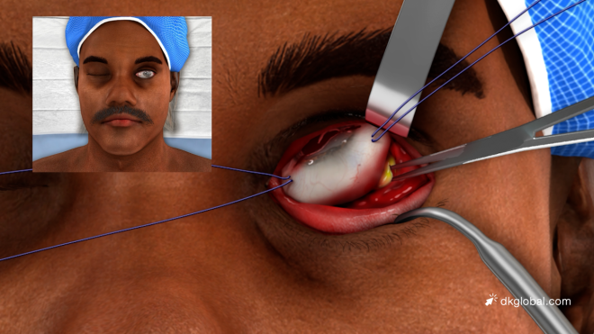 Defense Undervalued the Loss of Victim’s Eye Until They Saw It Themselves