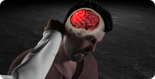 Security Guard Records His Attack on a Store Customer Who Suffered a TBI