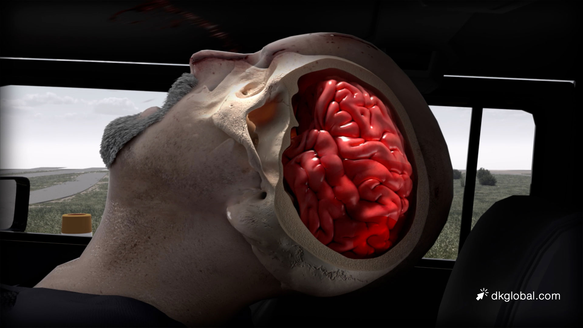 Negligent Truck Driver Destroys Man’s Livelihood and Pastime in One Fell Swoop