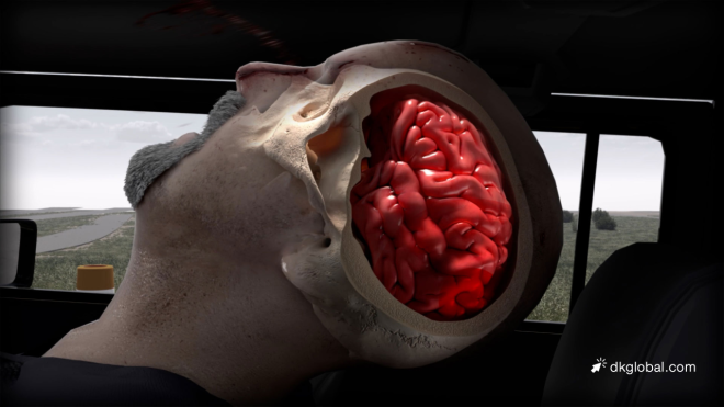Negligent Truck Driver Destroys Man’s Livelihood and Pastime in One Fell Swoop