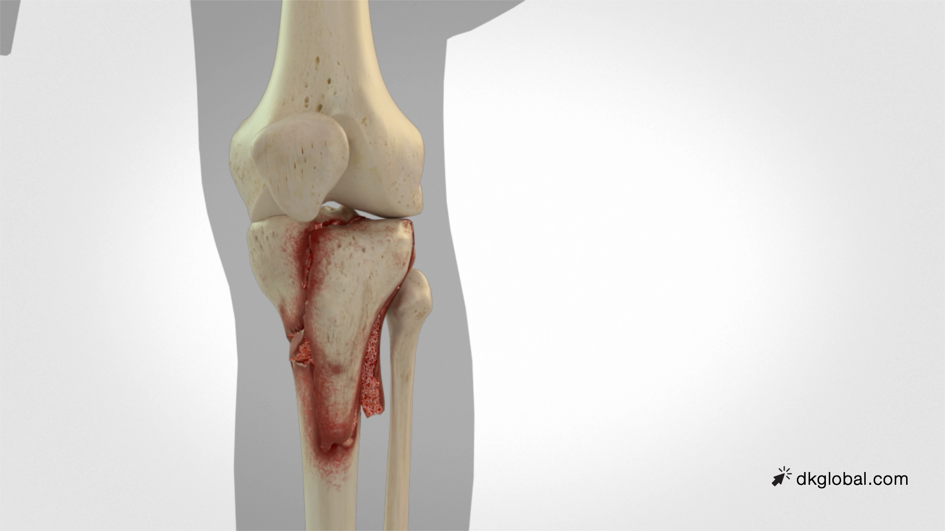Heads Up! This Week's Case Features