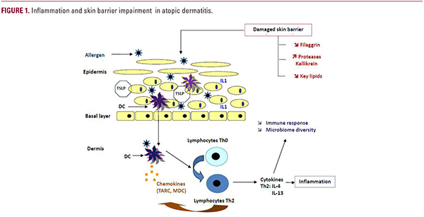A Global Review on the Risk Factors and Management of Early Atopic ...