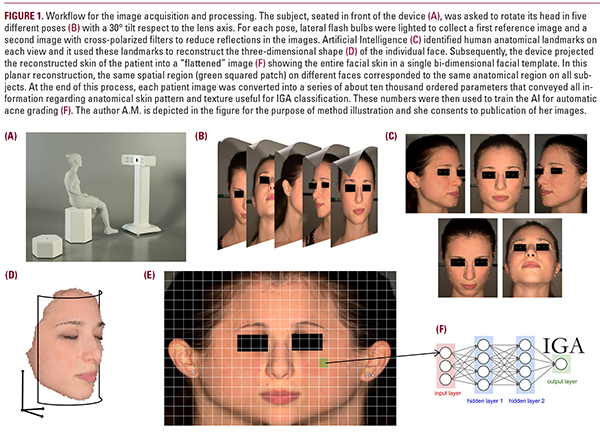 Artificial Intelligence for the Objective Evaluation of Acne ...