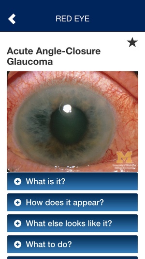 Screenshot EyesHaveIt on iPhone