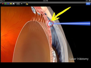 Screenshot Sight Selector Lite on iPad