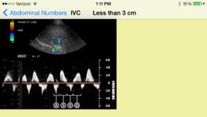 Screenshot Sonograpy Cheat Sheet: Abdominal on iPhone