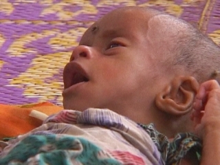 UN / CHILD MORTALITY