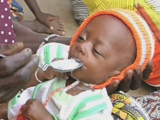 COTE D’IVOIRE / MALNUTRITON