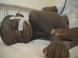 MOZAMBIQUE / WORLD MALARIA DAY ADVANCER