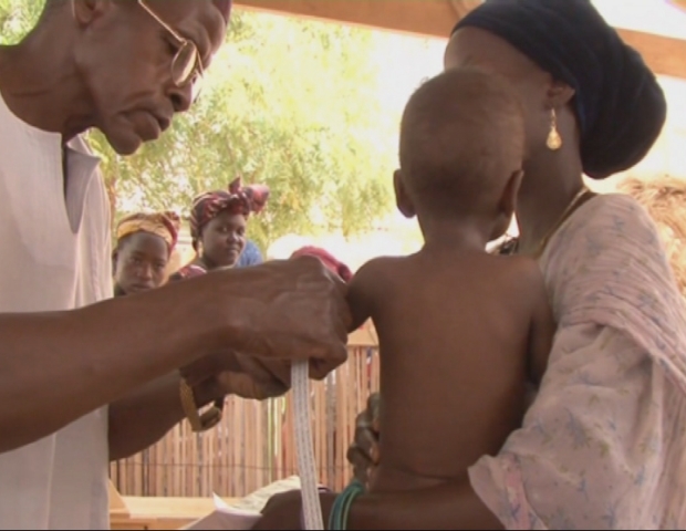 NIGER / MALNUTRITION 