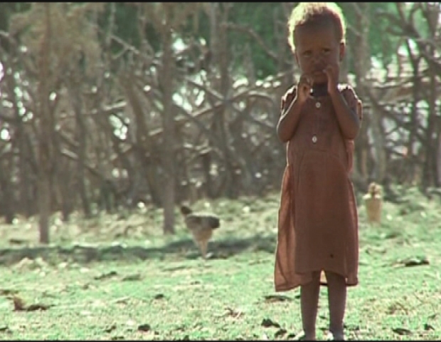 MADAGASCAR / MALNUTRITION