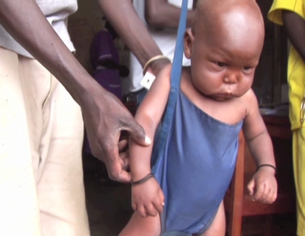 UGANDA / MALNUTRITION 
