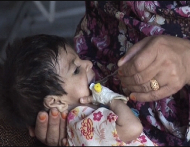 PAKISTAN / NOWSHERA MALNUTRITION
