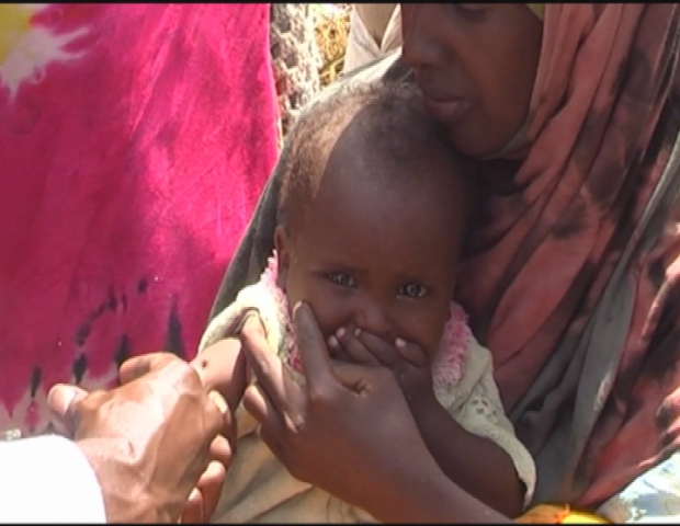 SOMALIA / MEASLES