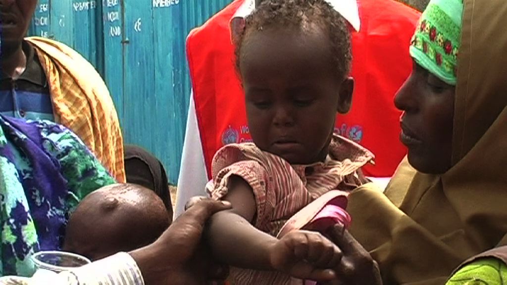 SOMALIA / MEASLES CAMPAIGN