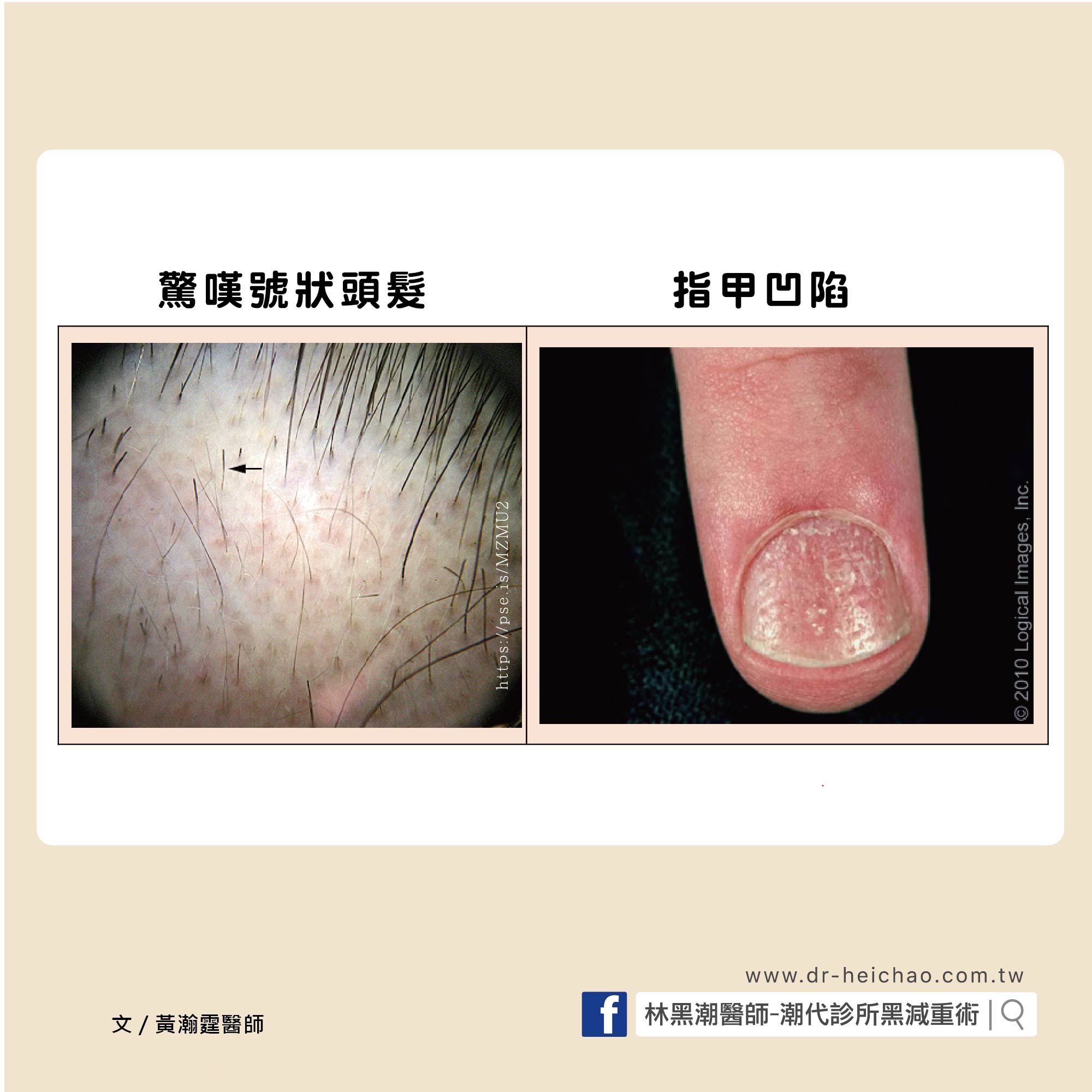 圓禿/文：黃瀚霆醫師 | 想減肥?