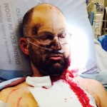 Grizzly attack survivor relates story