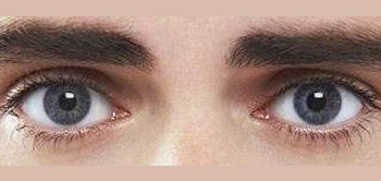 Optometrist, kids eye Amblyopia without Strabismus in Old Bridge, NJ