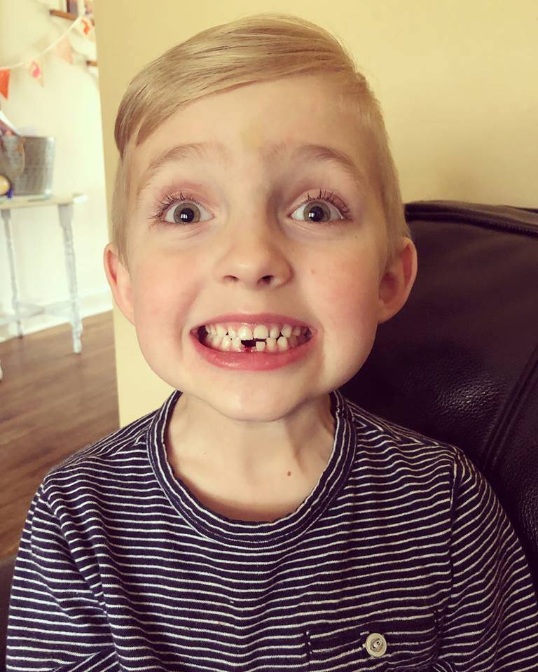 Tooth
