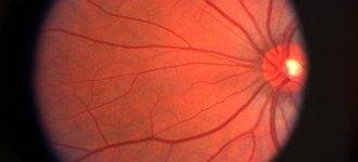 Retina small 330x150