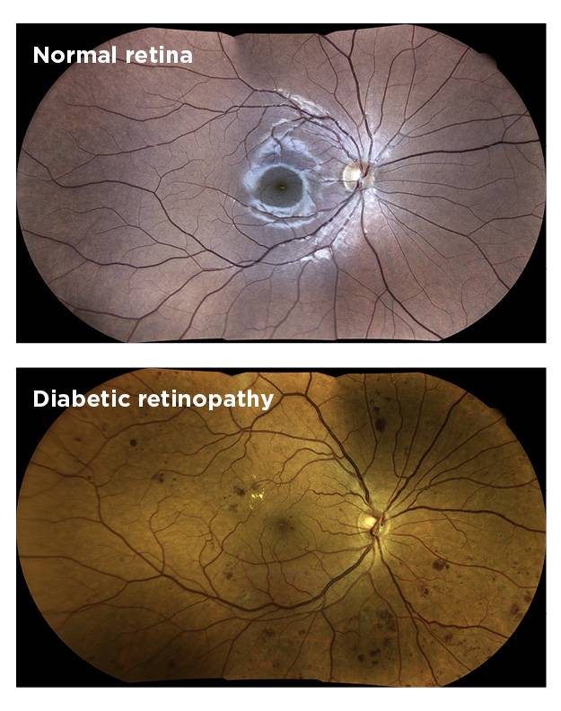 optometrist near you