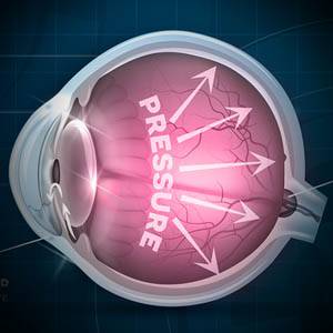 Eye Gallery Glaucoma 1.jpg