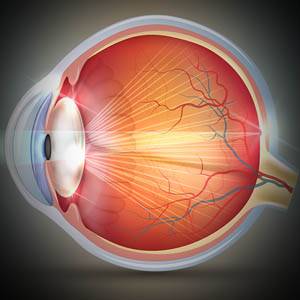 Eye Gallery catarcts 1.jpg